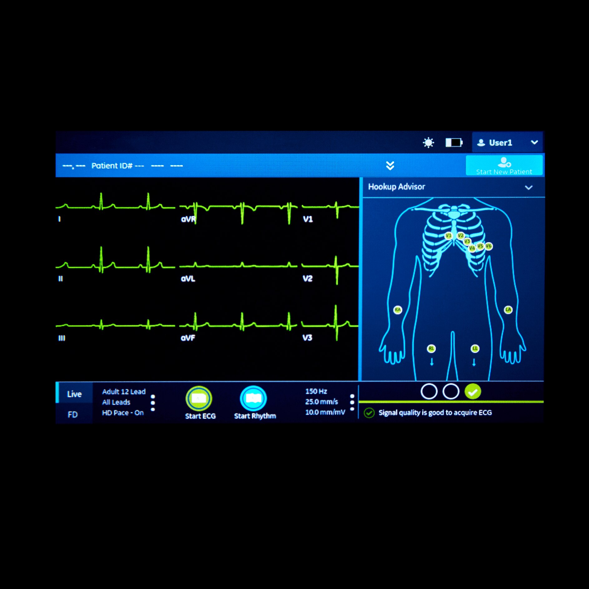 MAC™ 5 Resting ECG MAC™ 5 Resting ECG